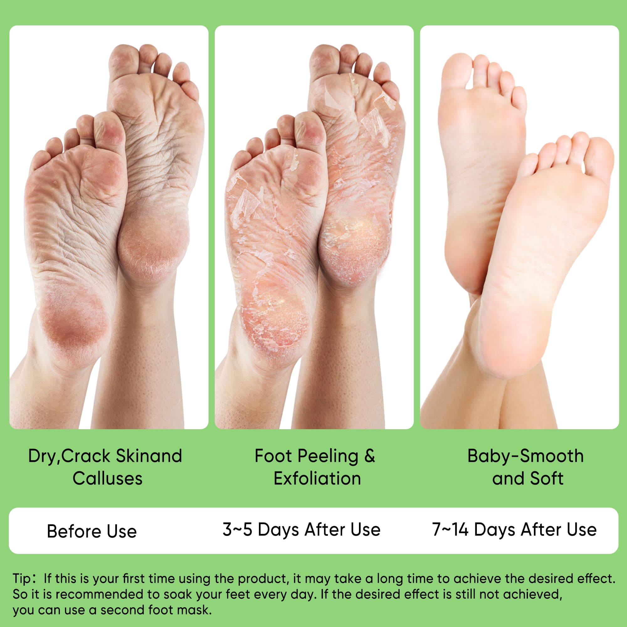 Mascarilla de aloe Berlaney para talones: relajación y suavidad aseguradas.