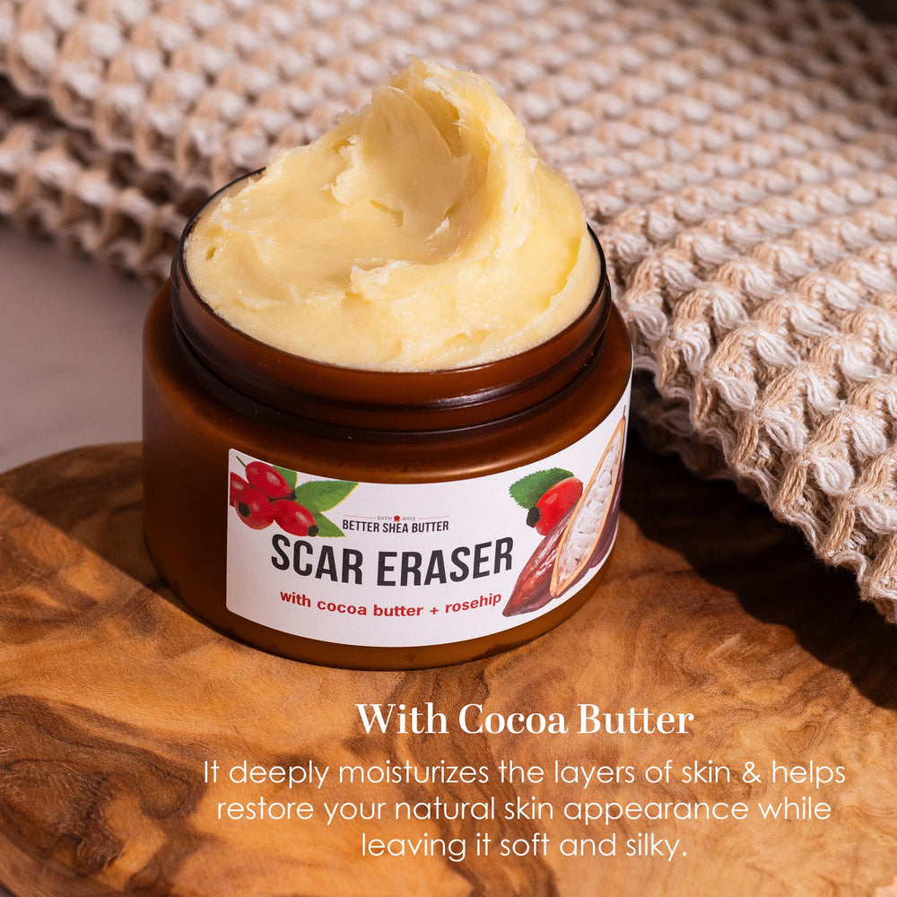 Cream swirl of Better Shea Butter Scar Eraser Balm highlighting cocoa butter formula