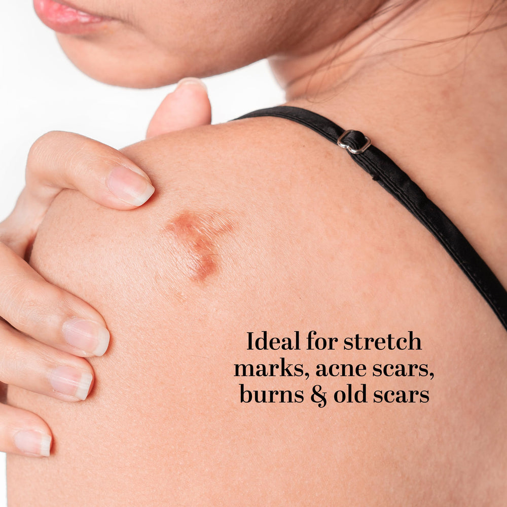 Close-up of Better Shea Butter Scar Eraser Balm label and ingredients
