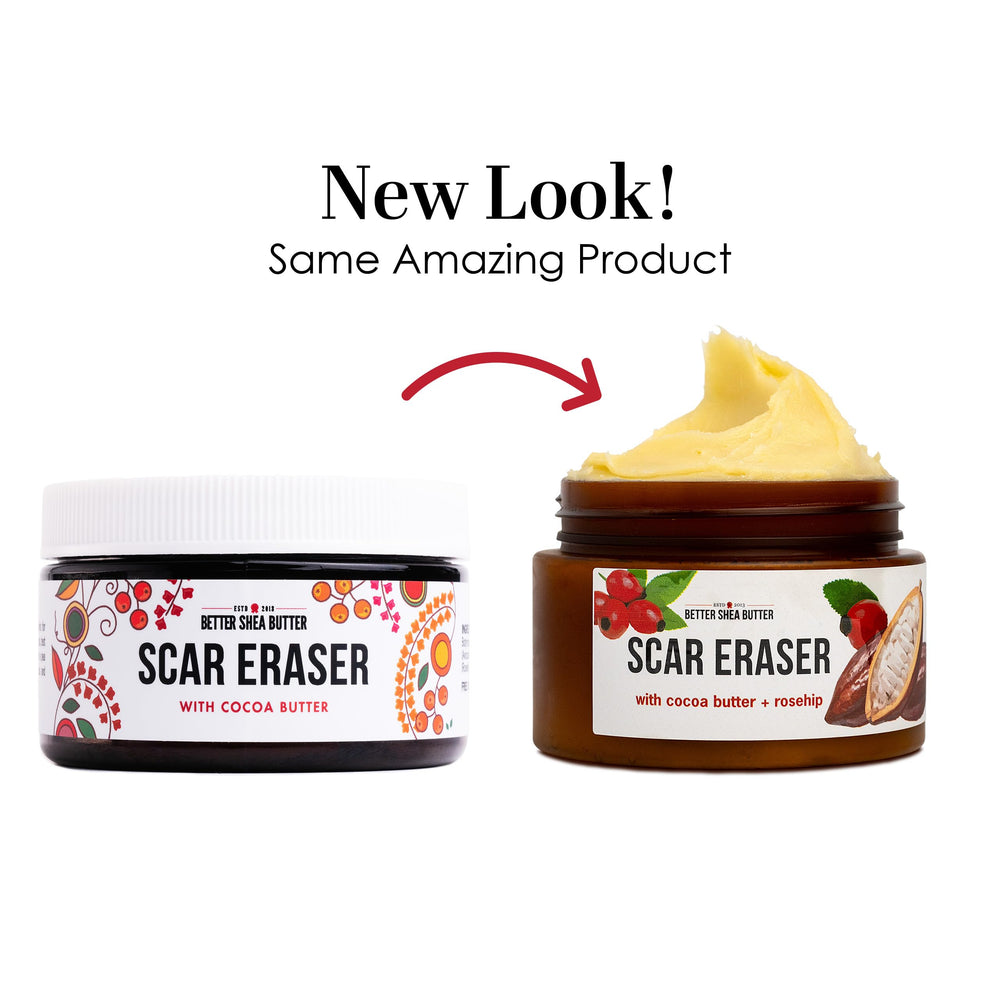 Packaging close-up of Better Shea Butter Scar Eraser Balm