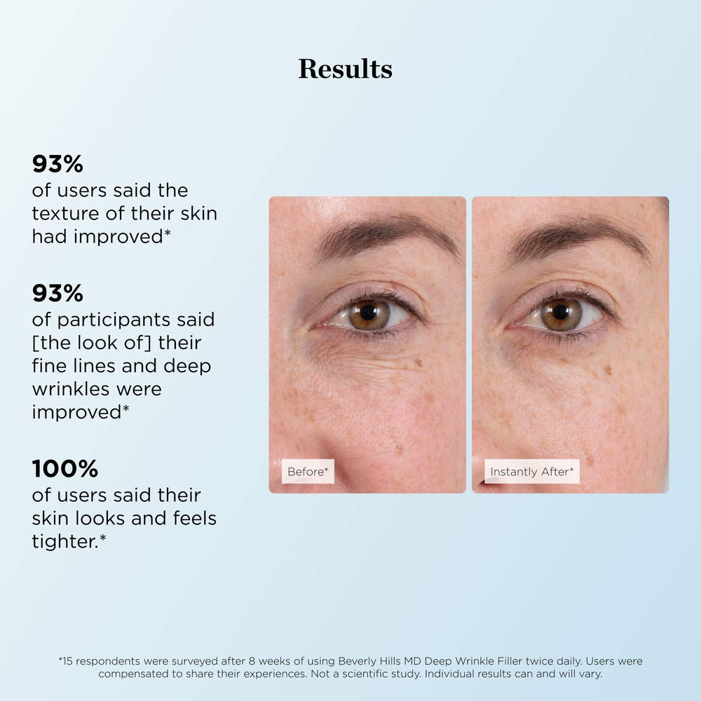 Beverly Hills MD Deep Wrinkle Filler diamond dust detail for radiant, soft focus