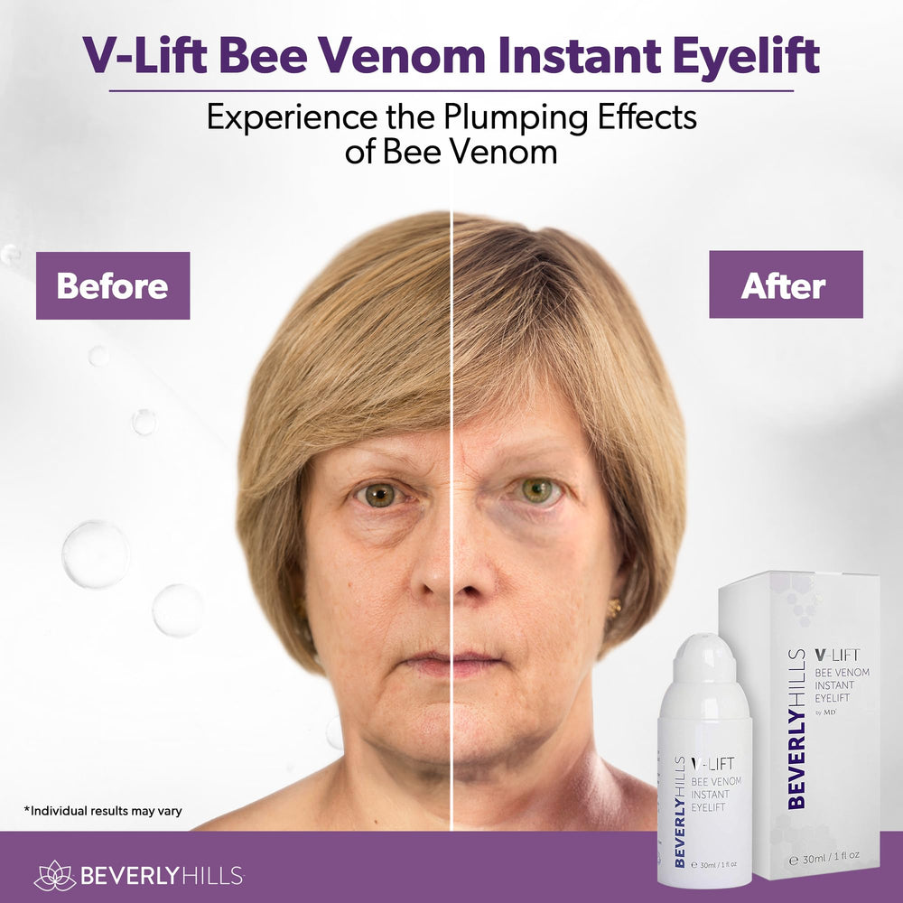 BEVERLY HILLS V-Lift packaging box signaling premium eye care.