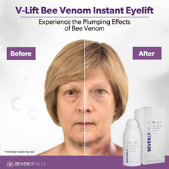 BEVERLY HILLS V-Lift packaging box signaling premium eye care.