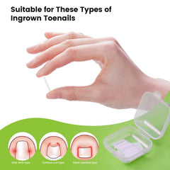 BEZOX custom-fit toenail strips adapting to your nail shape for comfort.