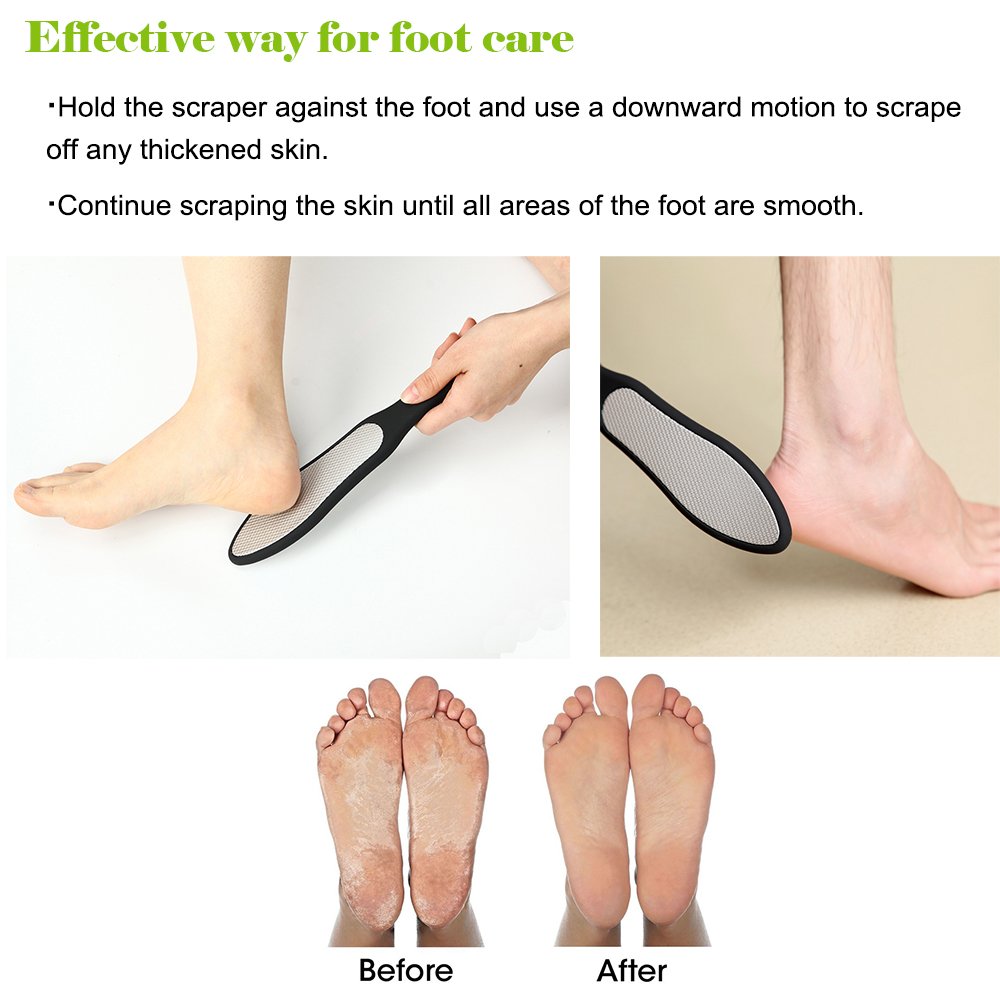 BEZOX foot file durable metal surface for long-lasting use