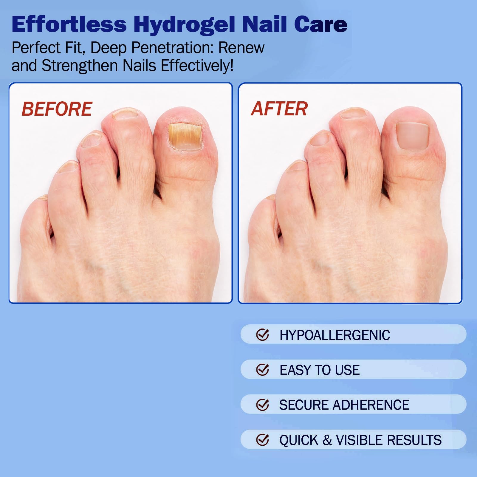 BFGCKJ deep-nail support patches promote moisturized nail beds.
