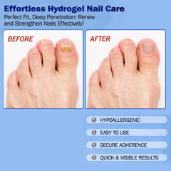 BFGCKJ deep-nail support patches promote moisturized nail beds.