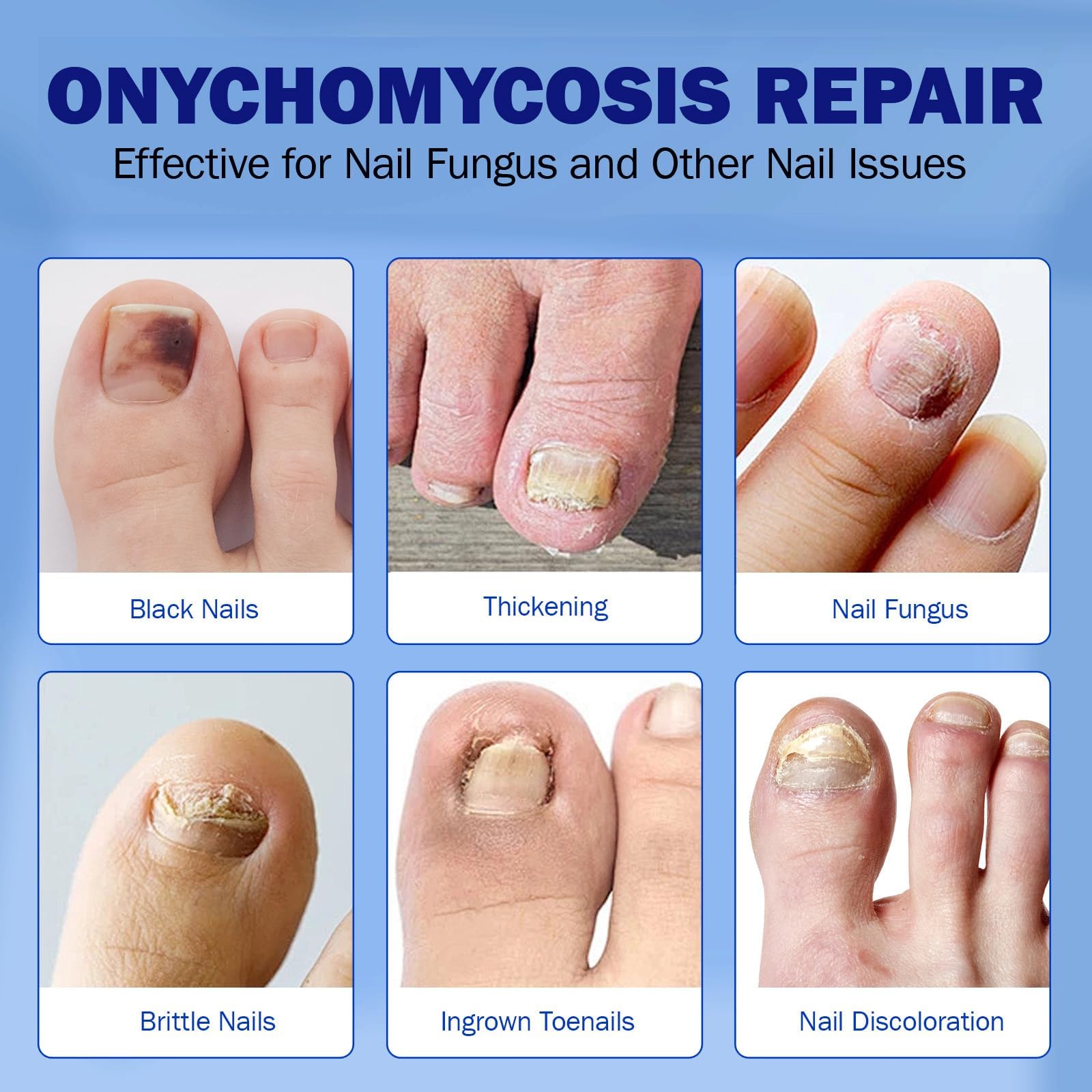 BFGCKJ sleep-treatment patches deliver care during 6–8 hours of sleep.
