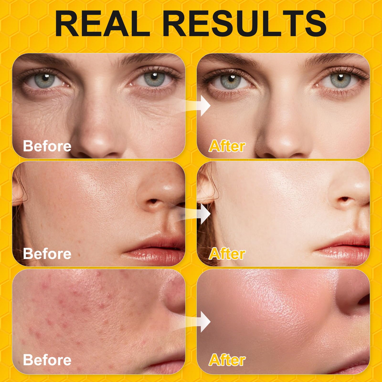 BIETCR uso facial y corporal para piel sensible