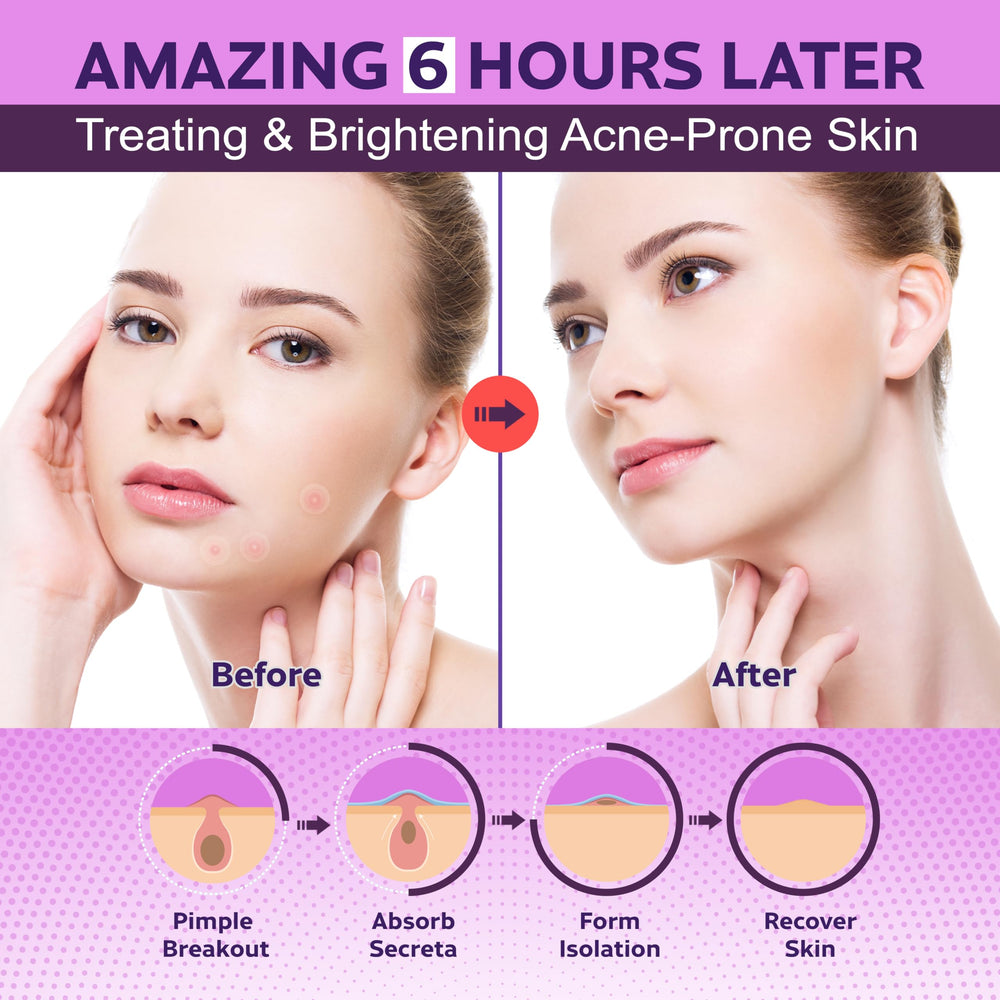 BIO'LEARY FSA/HSA accepted patches help budget-friendly skincare.