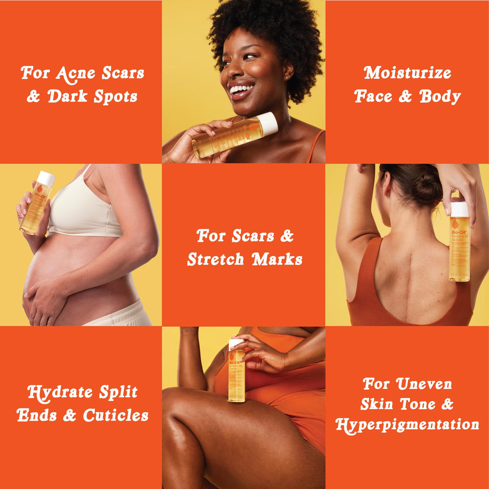 Bio-Oil jojoba oil features balanced hydration for dry skin without clogging pores.