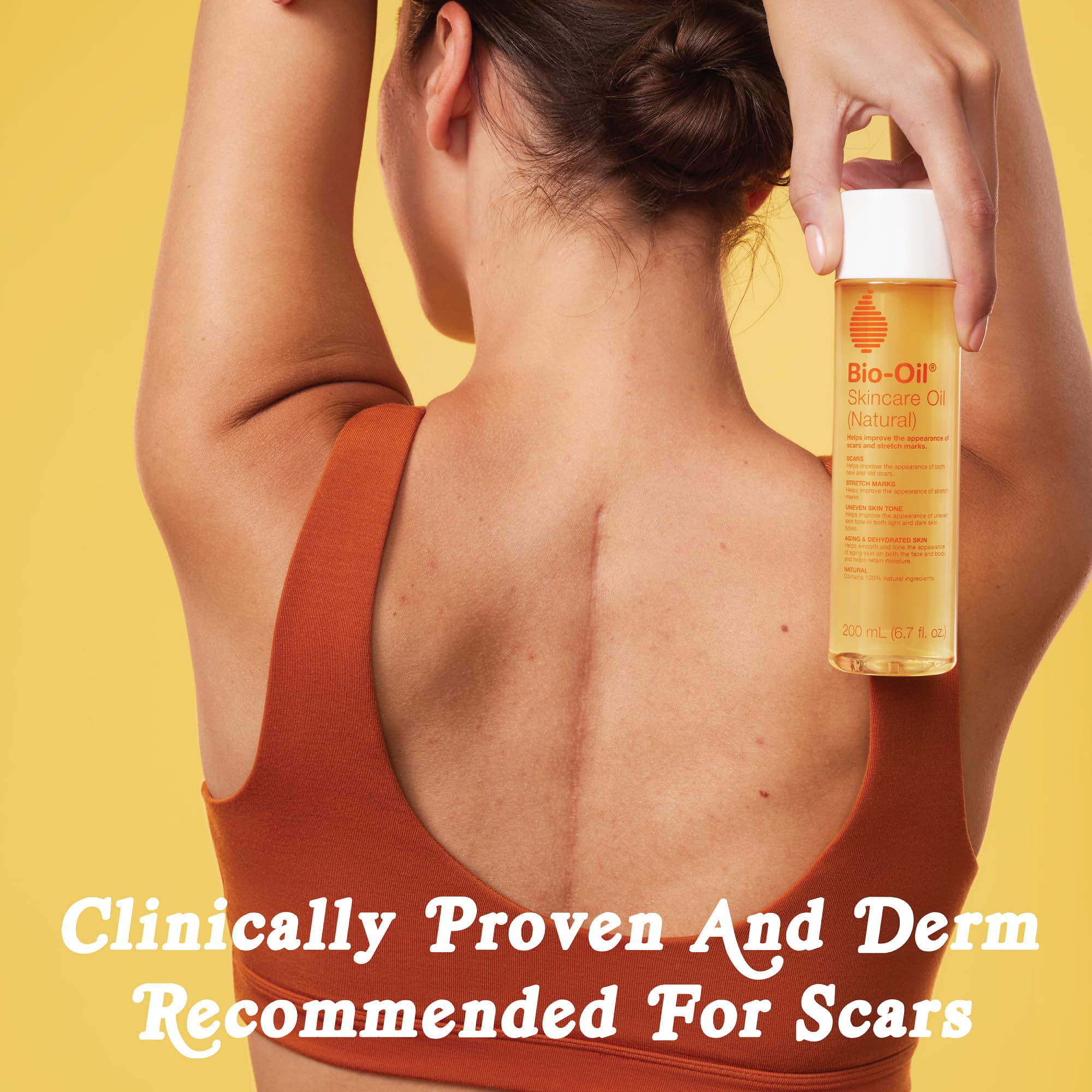 Bio-Oil scar and stretch marks serum application suggests improvement of marks with consistent use