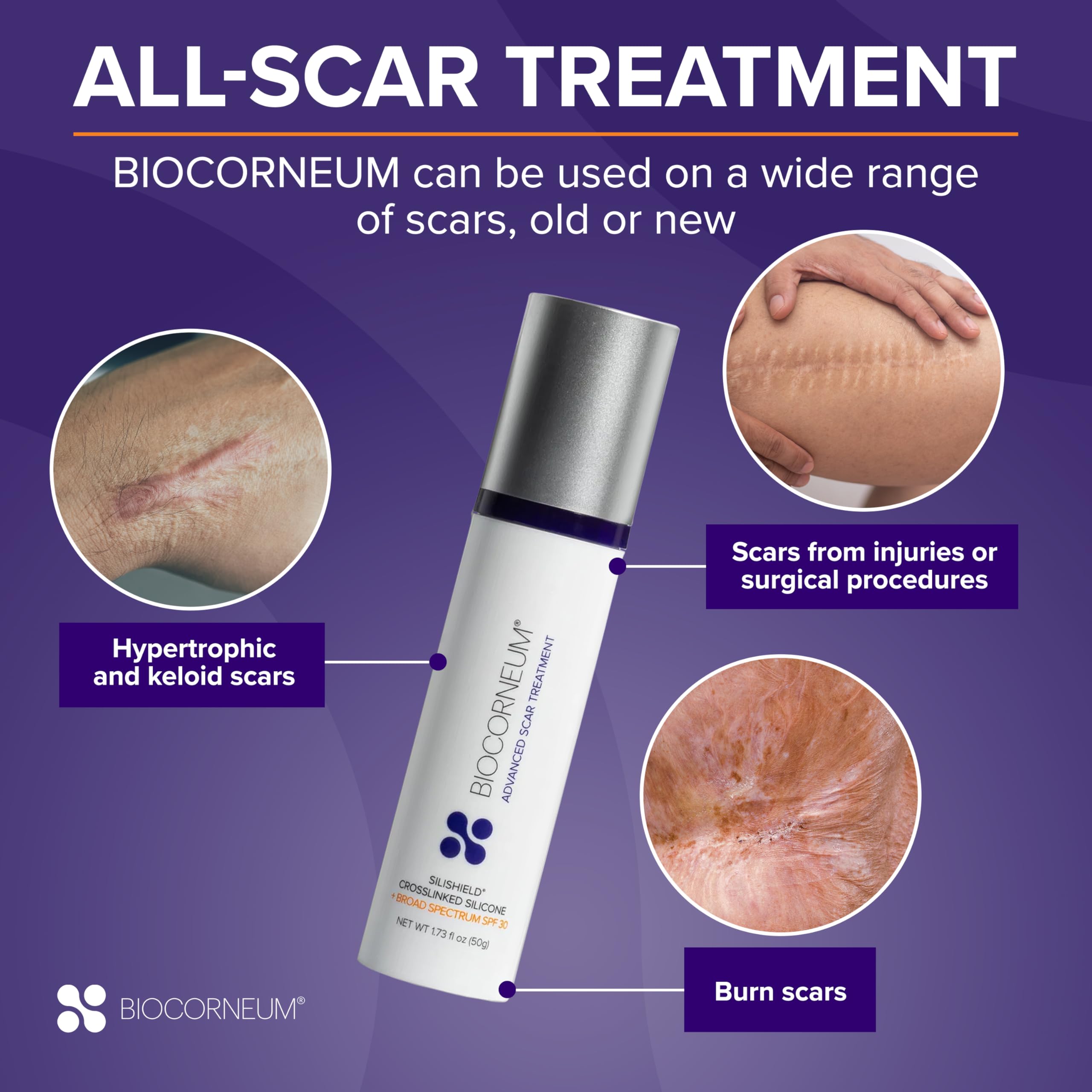 Biocorneum fast-drying silicone formula promotes quick absorption into the skin.
