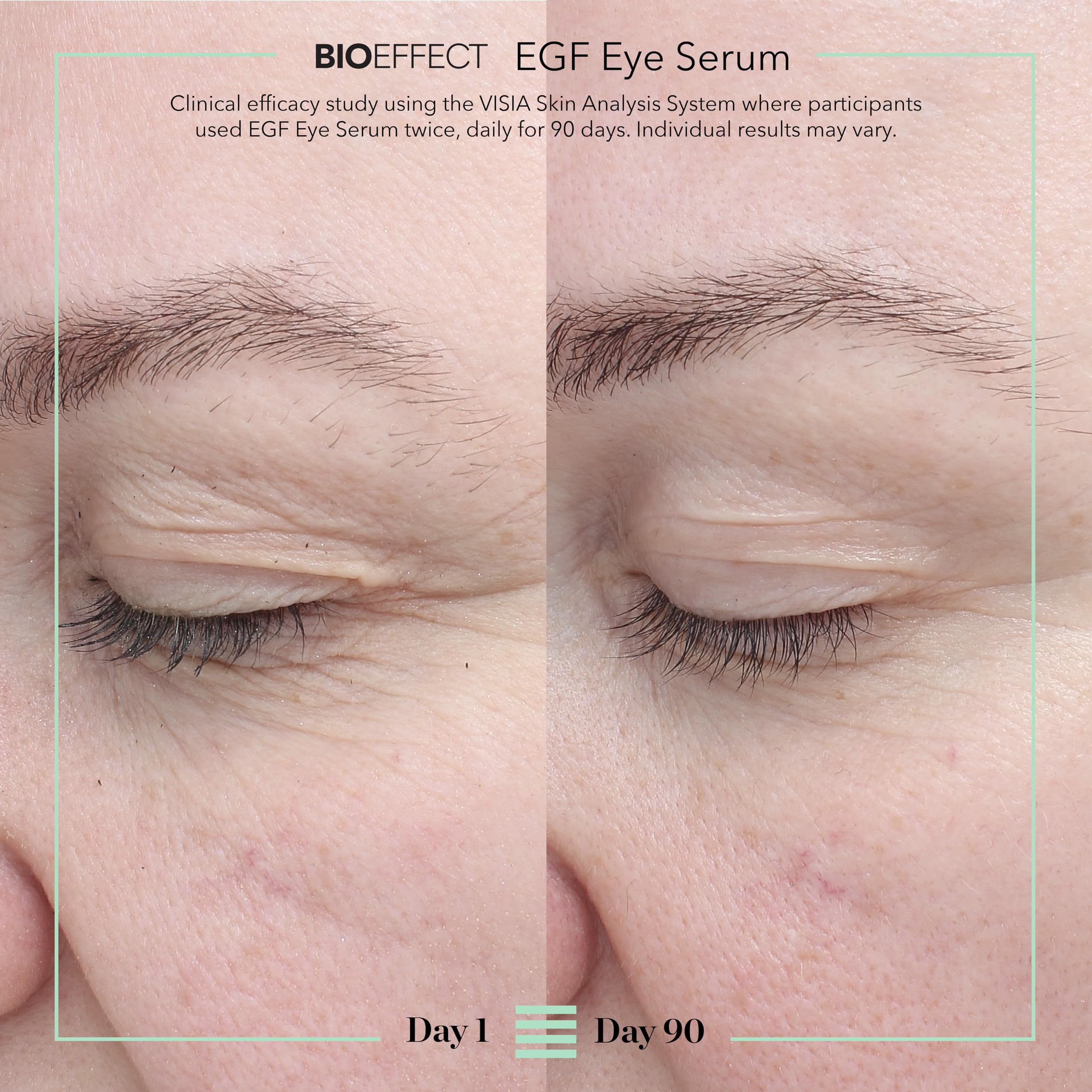 BIOEFFECT EGF Eye Serum brightens the under-eye area for a refreshed look.