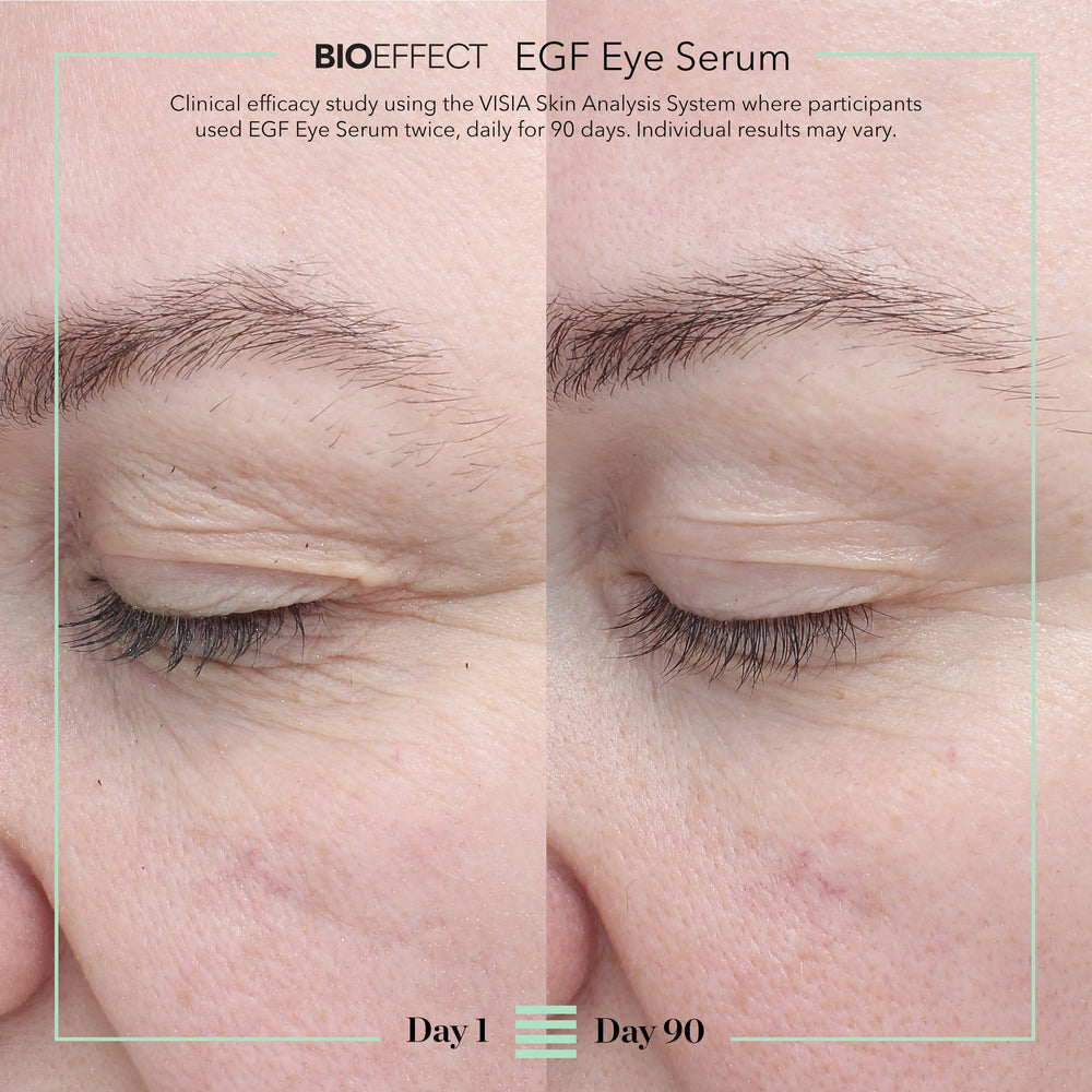 BIOEFFECT EGF Eye Serum brightens the under-eye area for a refreshed look.