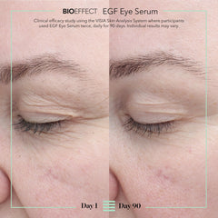 BIOEFFECT EGF Eye Serum brightens the under-eye area for a refreshed look.