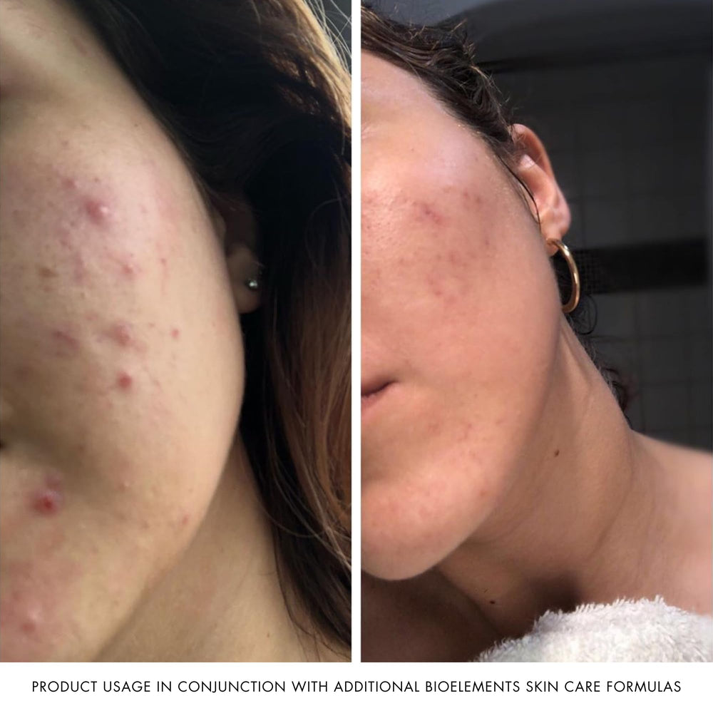 Spa-inspired presentation suggests an at-home pampering skincare moment.