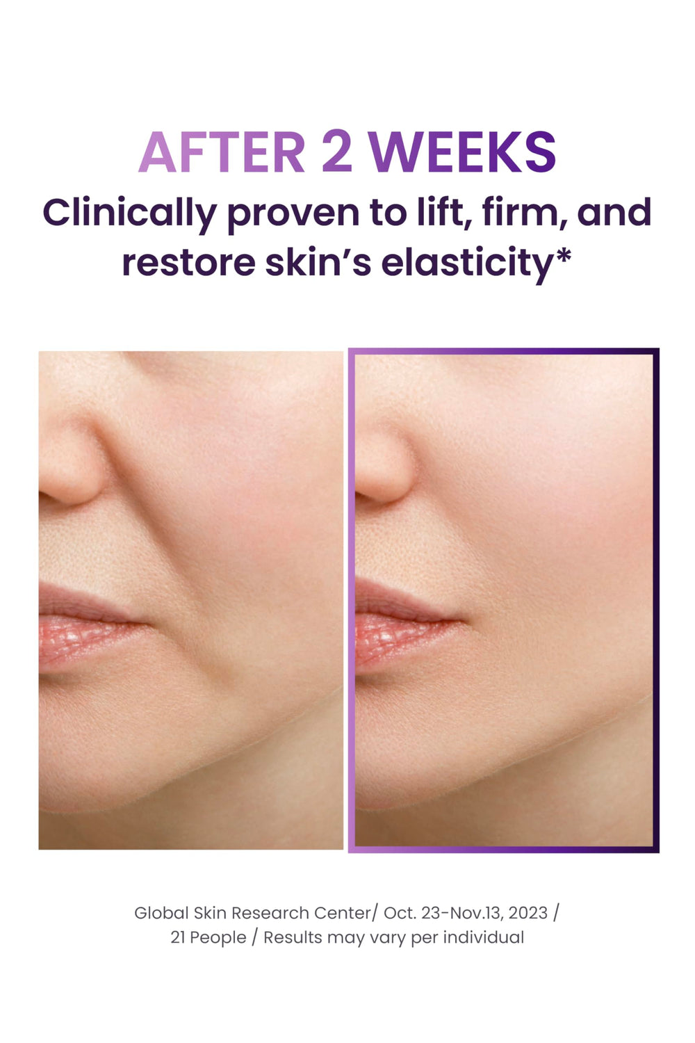 BIOHEAL BOH Probioderm 3D lifting ampoule usage steps for easy routine