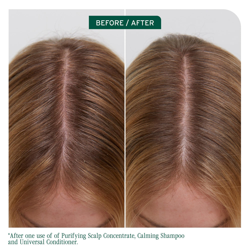 Biolage Scalp Sync Calming Shampoo creamy lather demonstrating gentle cleansing for sensitive scalps.