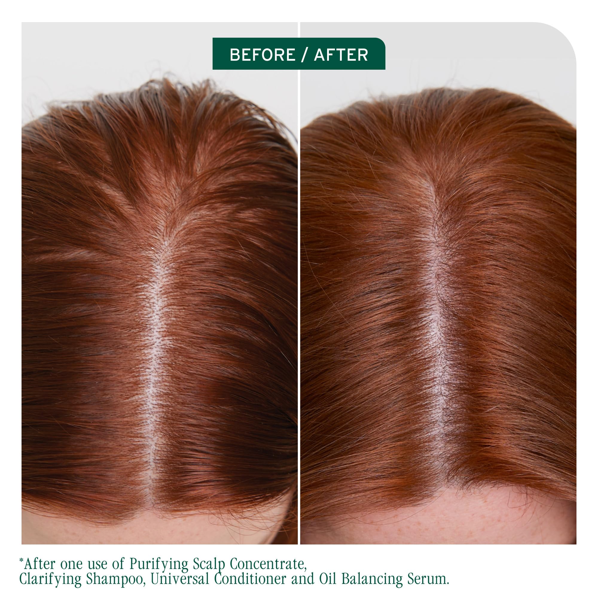 Biolage Scalp Sync bottle pour demonstrates cleansing for oily scalps