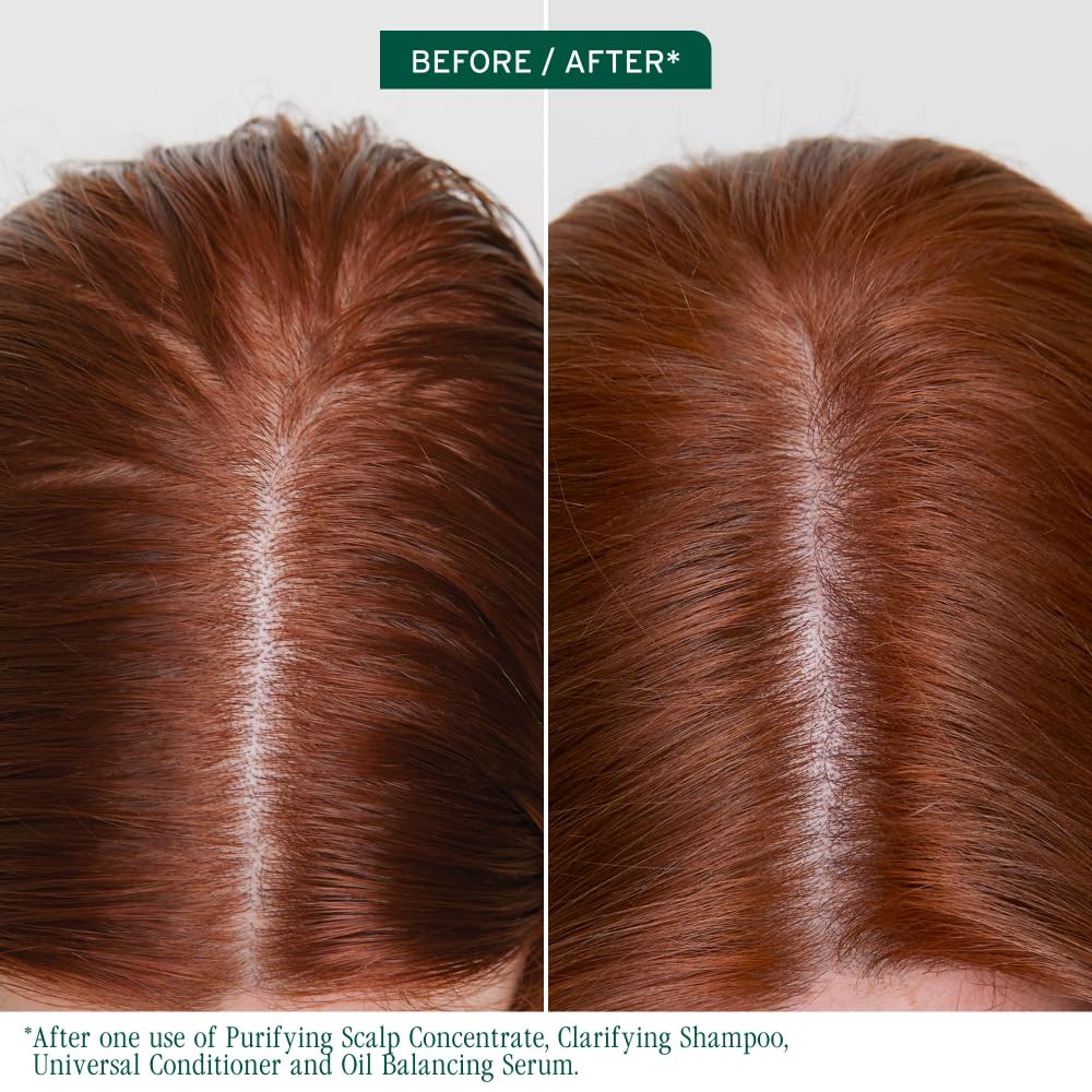 Biolage Scalp Sync serum drop dispensed illustrating precise application on the scalp.