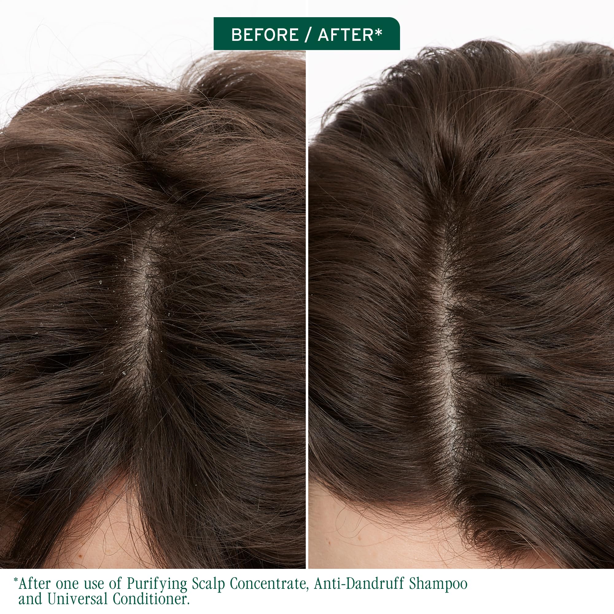 Biolage Scalp Sync Shampoo cap close-up showing zinc-pyrithione formula for dandruff control