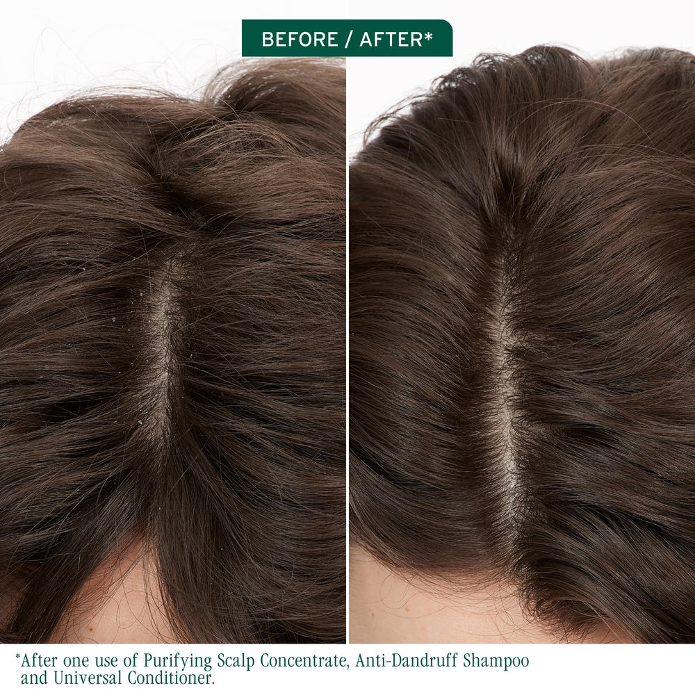 Biolage Scalp Sync Shampoo cap close-up showing zinc-pyrithione formula for dandruff control