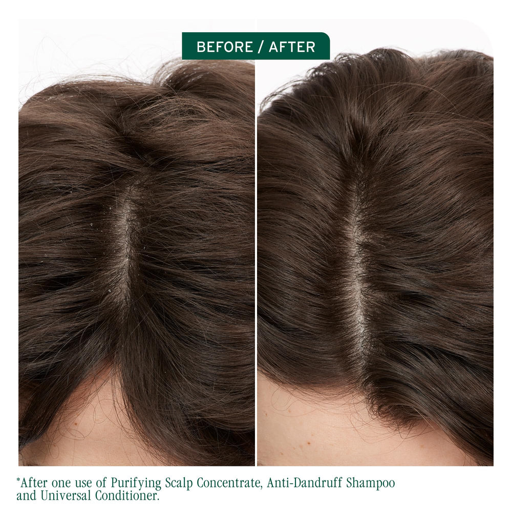 Biolage Scalp Sync bottle pour shows lather forming for scalp care