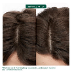 Biolage Scalp Sync bottle pour shows lather forming for scalp care