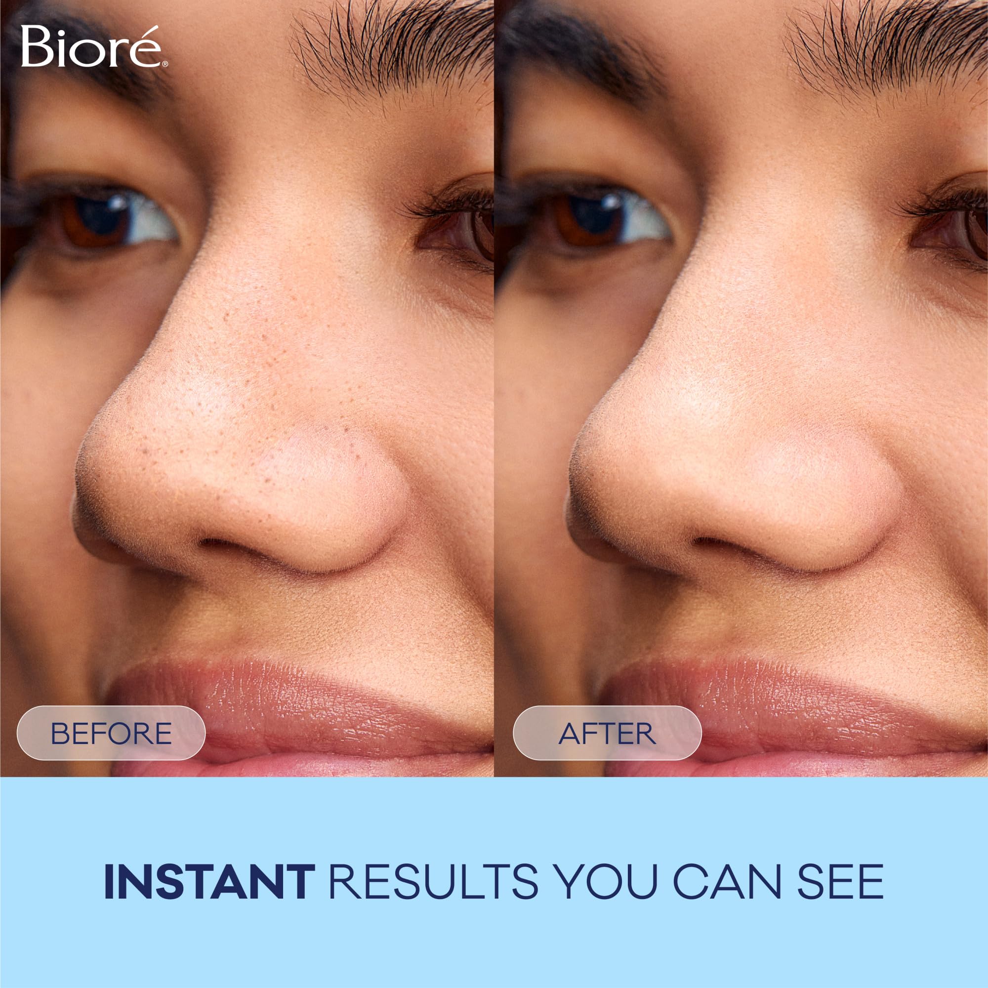 Biore deep cleansing strip after use leaves refreshed skin