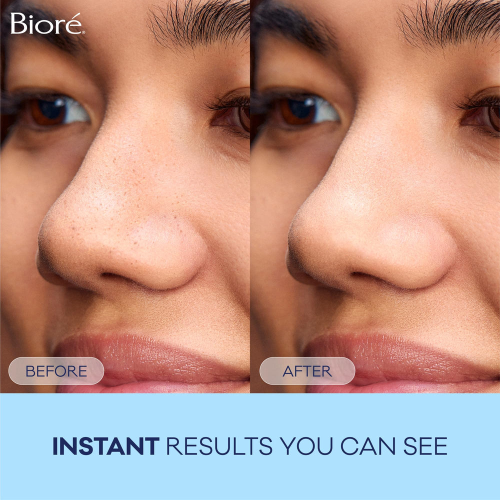 Biore deep cleansing strip after use leaves refreshed skin