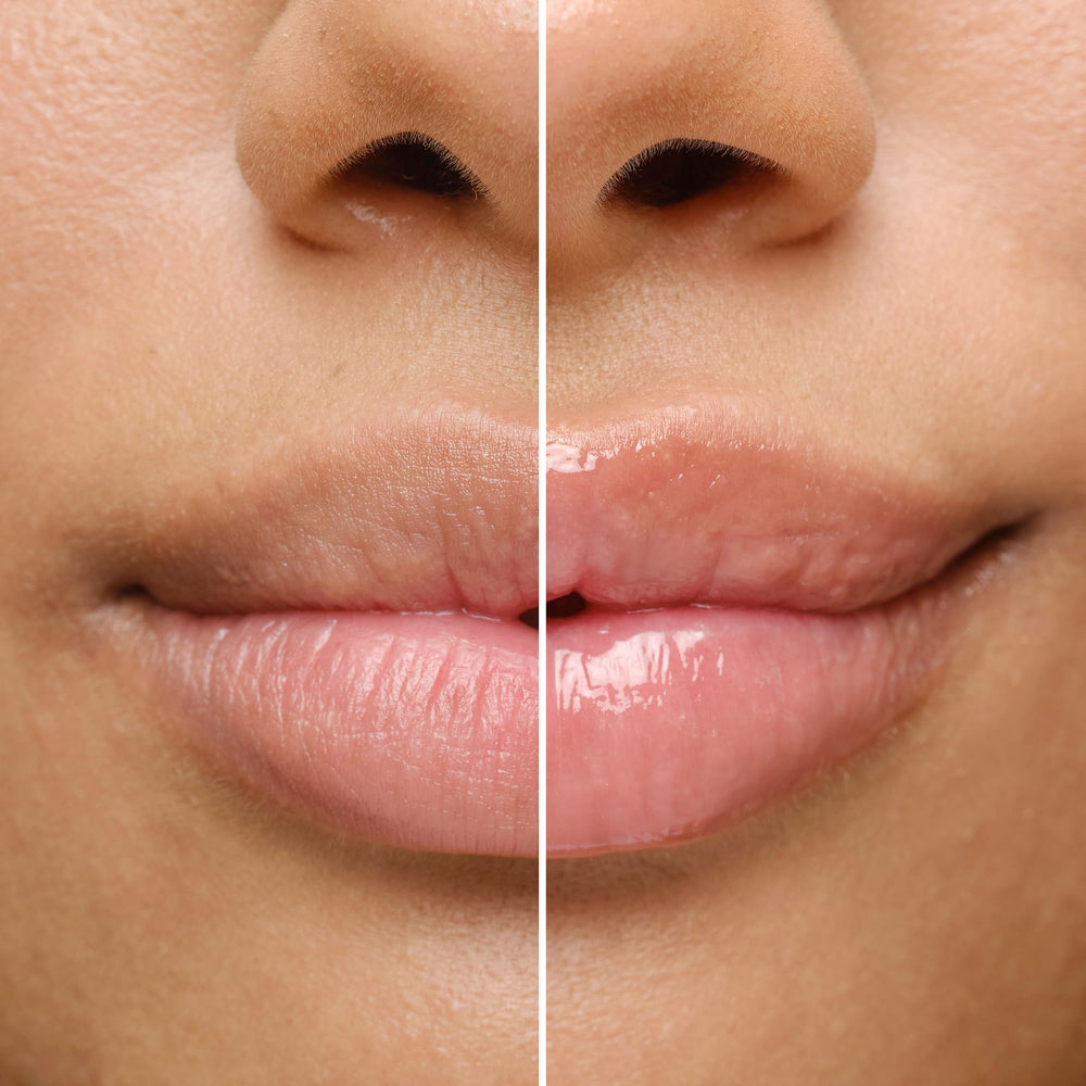 BIOSSANCE Ganador Allure 2025 para cuidado labial confiable