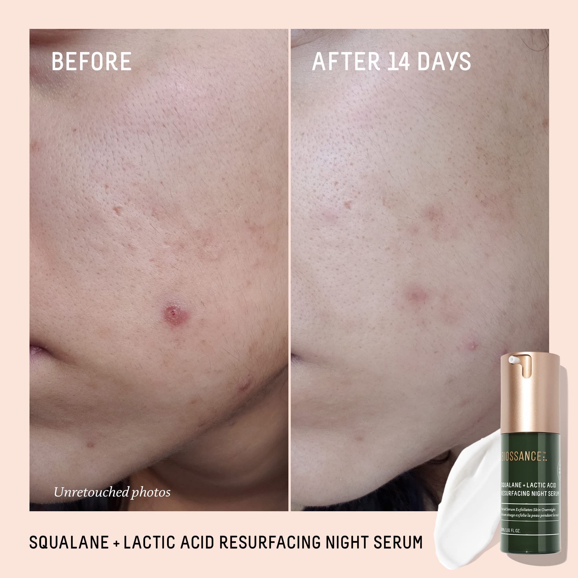 BIOSSANCE Lactic Acid Serum pump application shows easy nightly use.