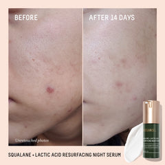 BIOSSANCE Lactic Acid Serum pump application shows easy nightly use.