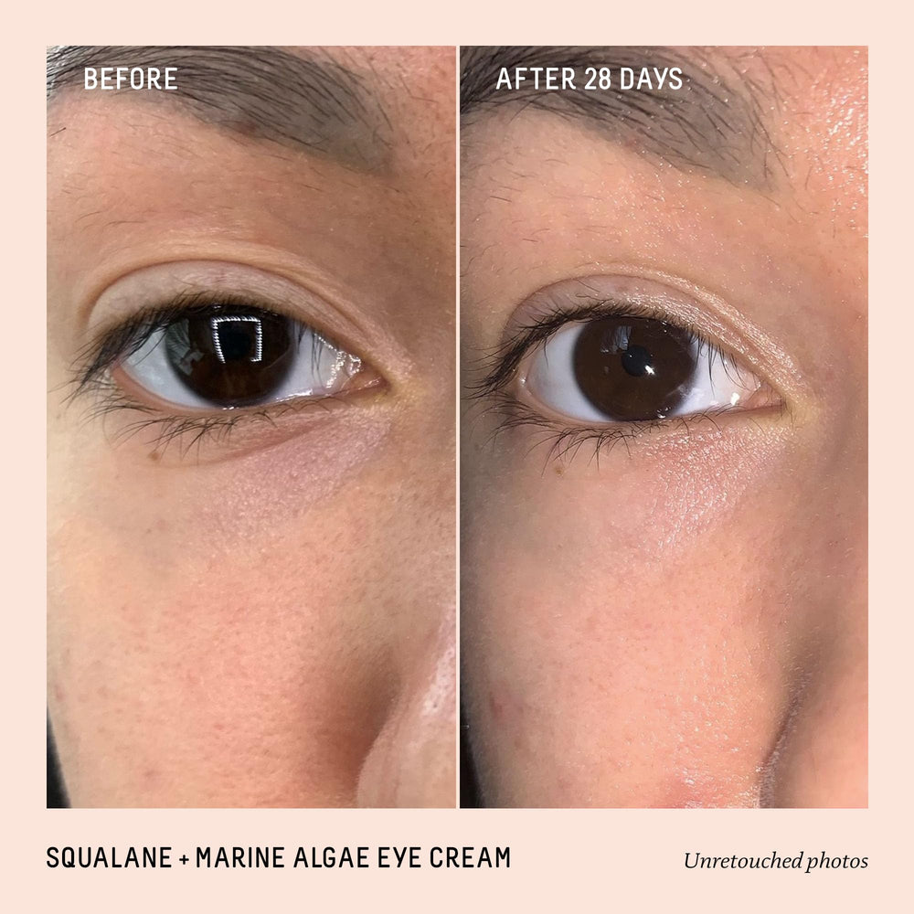 BIOSSANCE eye cream jar close-up highlighting creamy under-eye texture