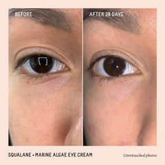BIOSSANCE eye cream jar close-up highlighting creamy under-eye texture