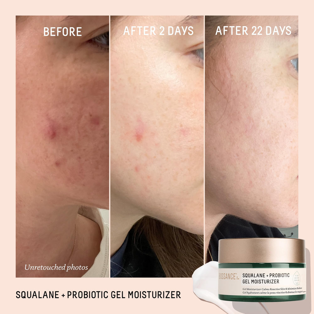 BIOSSANCE gel moisturizer night routine step demonstrates soothing hydration