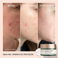 BIOSSANCE gel moisturizer night routine step demonstrates soothing hydration
