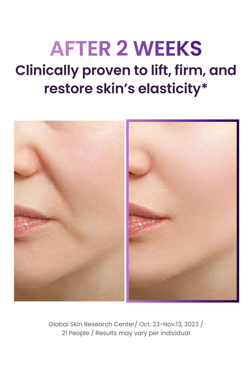 BIOHEAL BOH 3D lifting texture close-up highlighting elasticity.