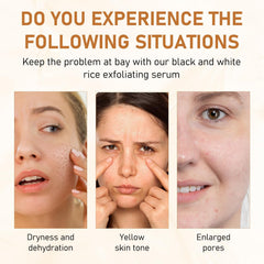 Birunwer fórmula hidratante durante la exfoliación para piel suave y cómoda.