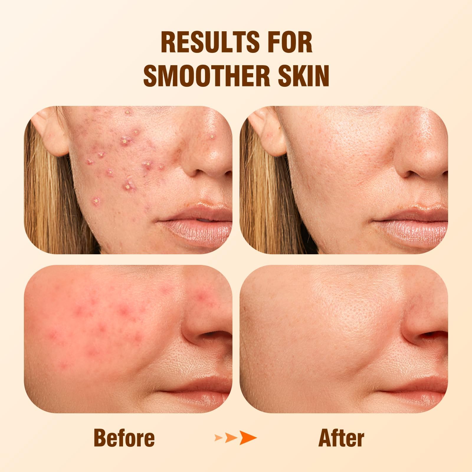 BIYSBER serum dropper close-up for precise dosage and gentle exfoliation.