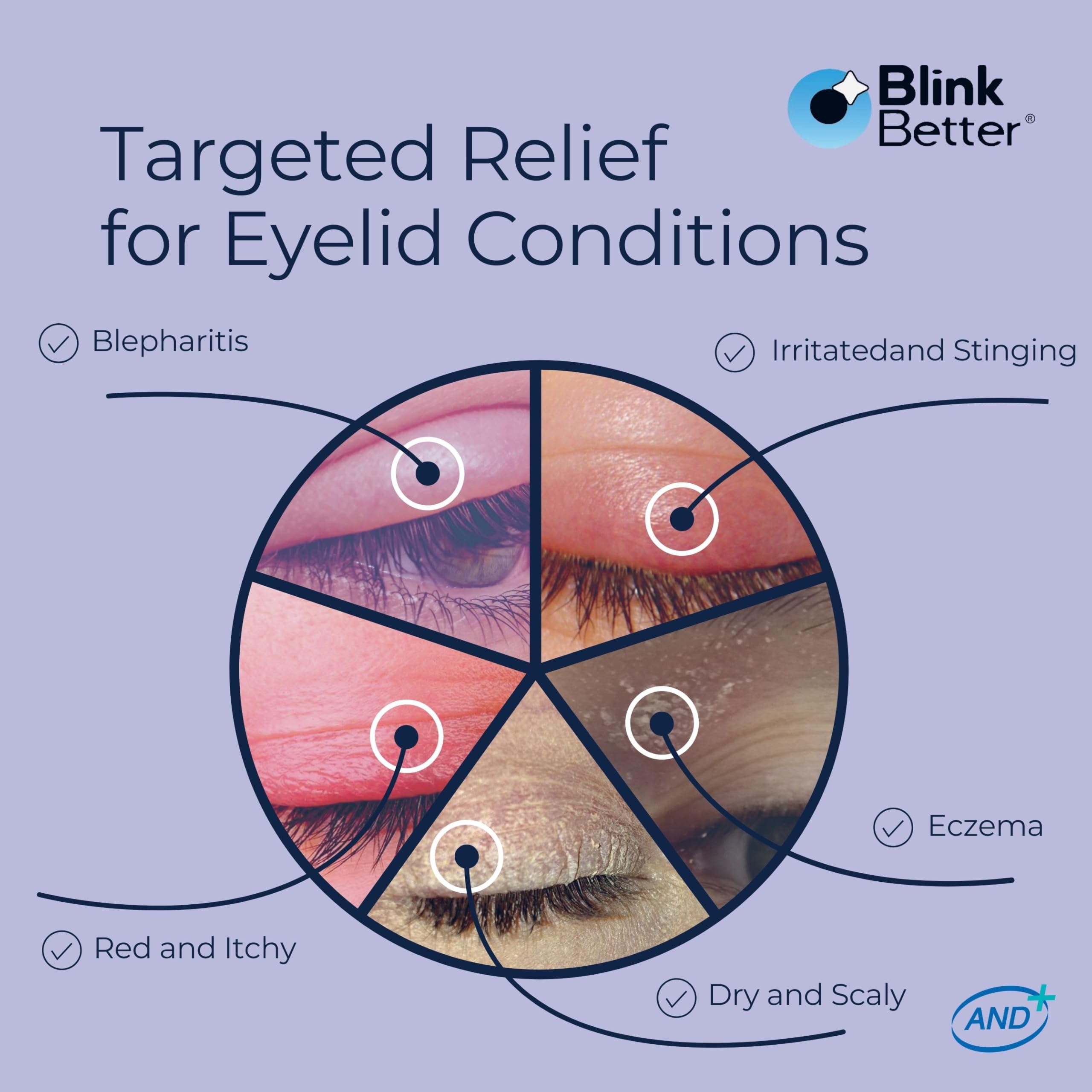BlinkBetter BetterLids: textura crema que forma barrera suave y calmante.