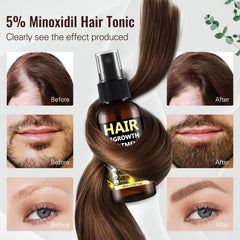 BLISSMATE regenera-capilar mujeres, fórmula avanzada para cabello más grueso con uso regular.