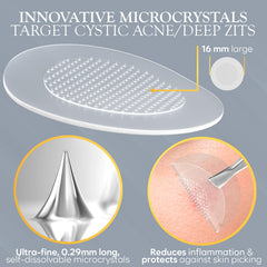Tecnología de microcristales entrega activos directamente a la imperfección