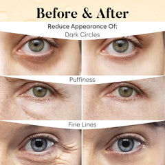 Bloomora dark circles brightening effect near eye area.