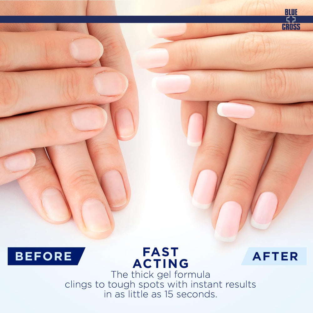 Blue Cross Quitacuticulas Gel enriquecido con espino amarillo para uñas sanas.