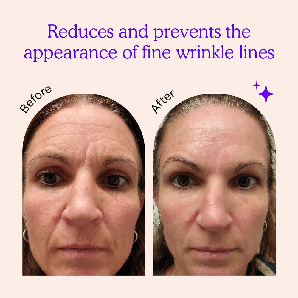 BLUMBODY forehead-wrinkles patch targeting brow lines overnight