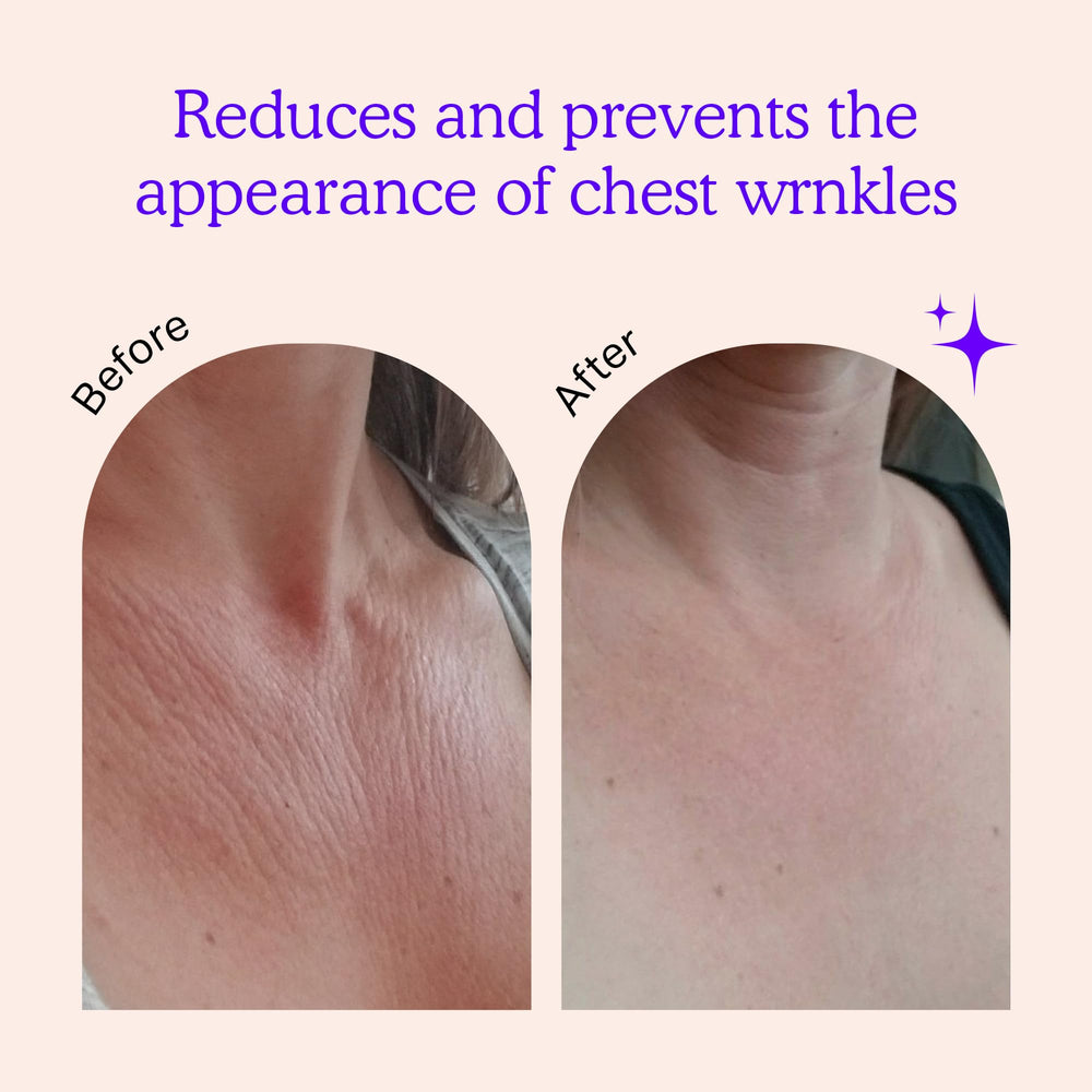 BLUMBODY chest wrinkle pads on skin application for overnight smoothing.