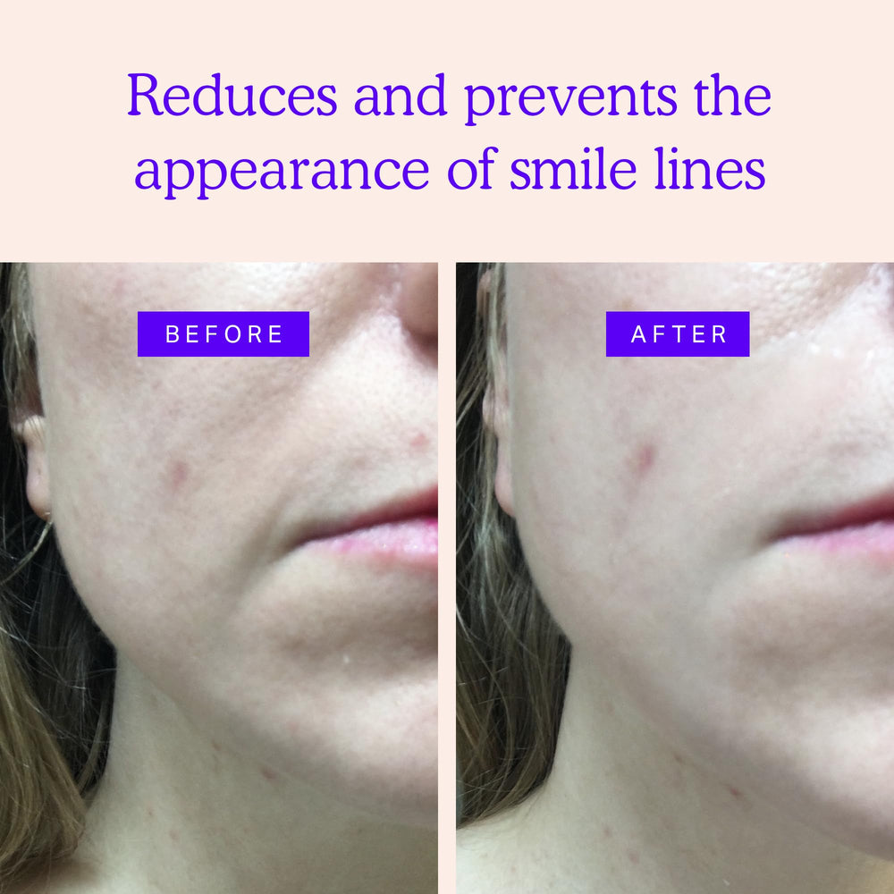 BLUMBODY Face patches near mouth for comfortable, discreet wear.