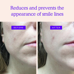 BLUMBODY Face patches near mouth for comfortable, discreet wear.